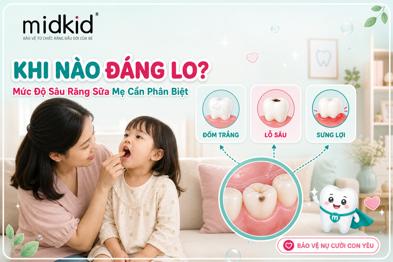 Khi nào sâu răng sữa đáng lo, mức độ mẹ cần phân biệt