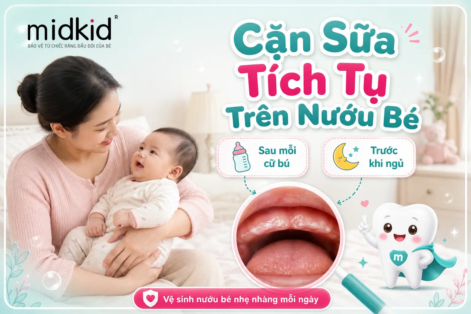 Cặn sữa tích tụ trên nướu bé