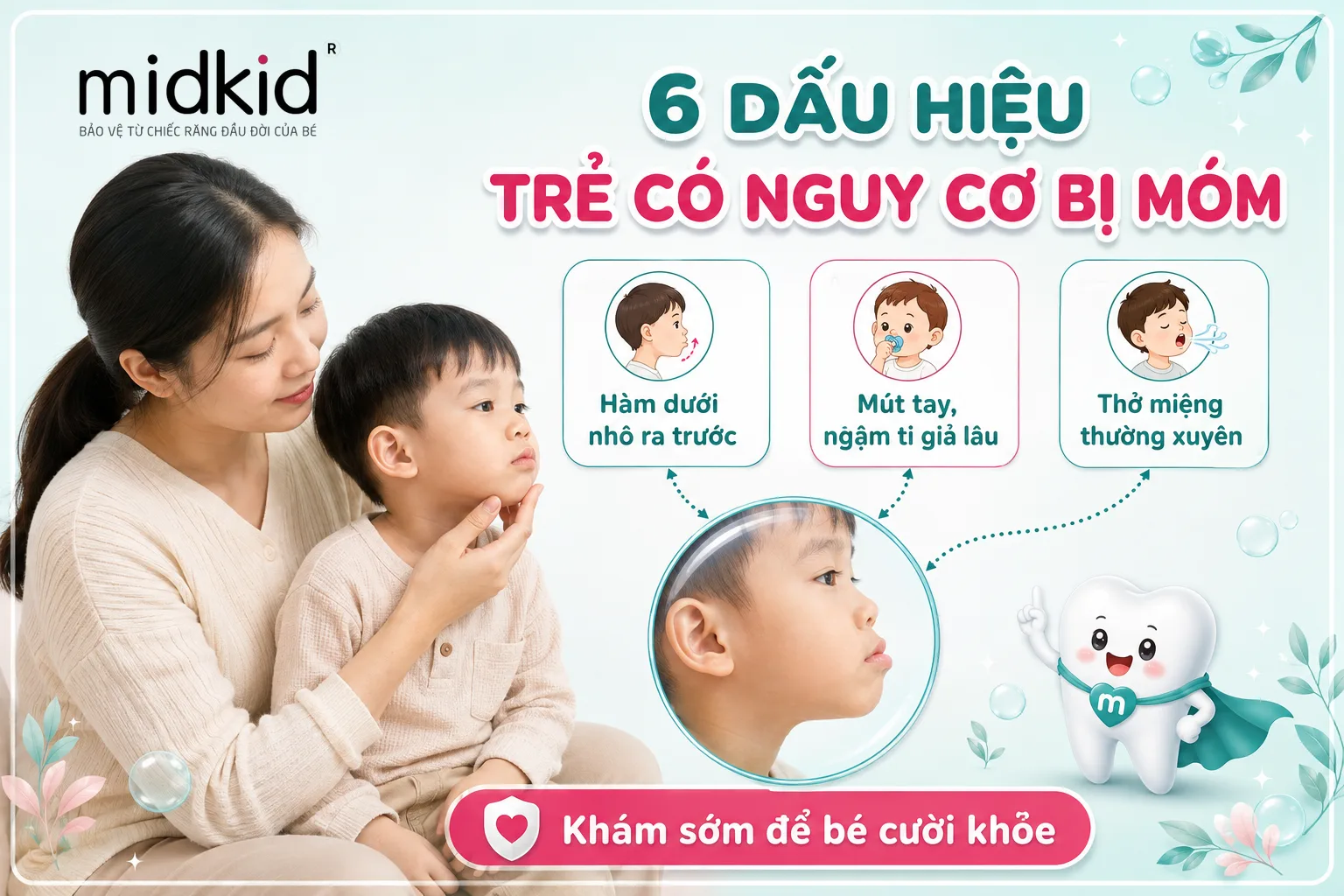 6 dấu hiệu trẻ có nguy cơ bị móm