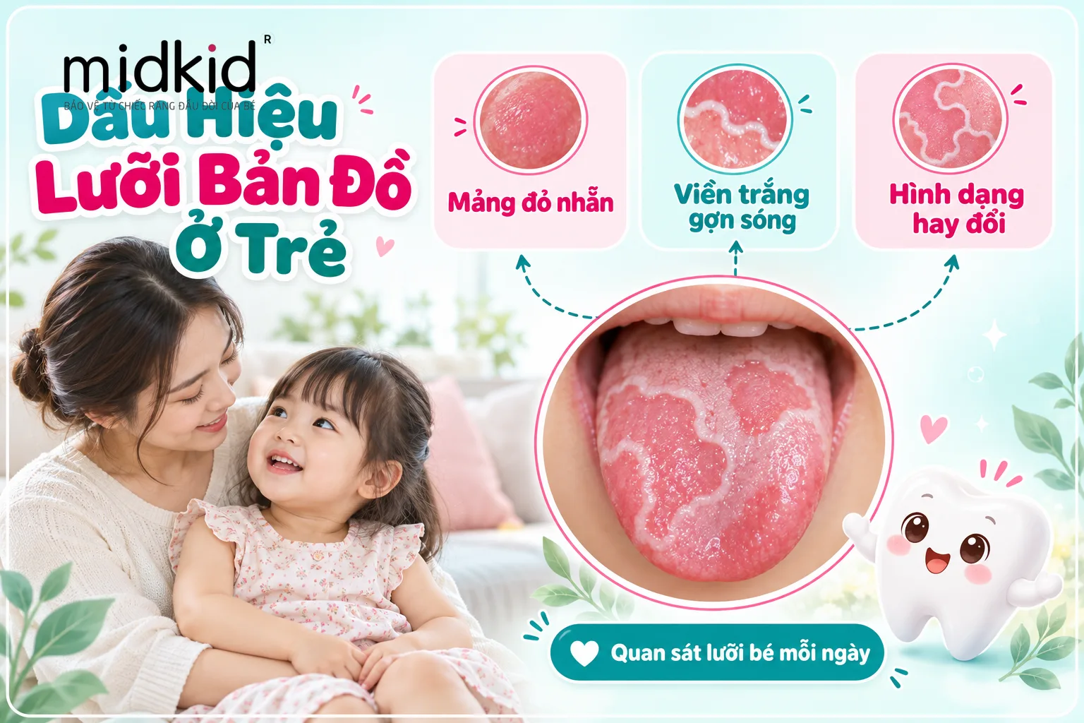 Cận cảnh lưỡi bản đồ ở trẻ với mảng đỏ nhẵn và viền trắng gợn sóng